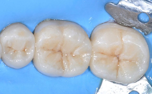 ODONTOIATRIA CONSERVATIVA