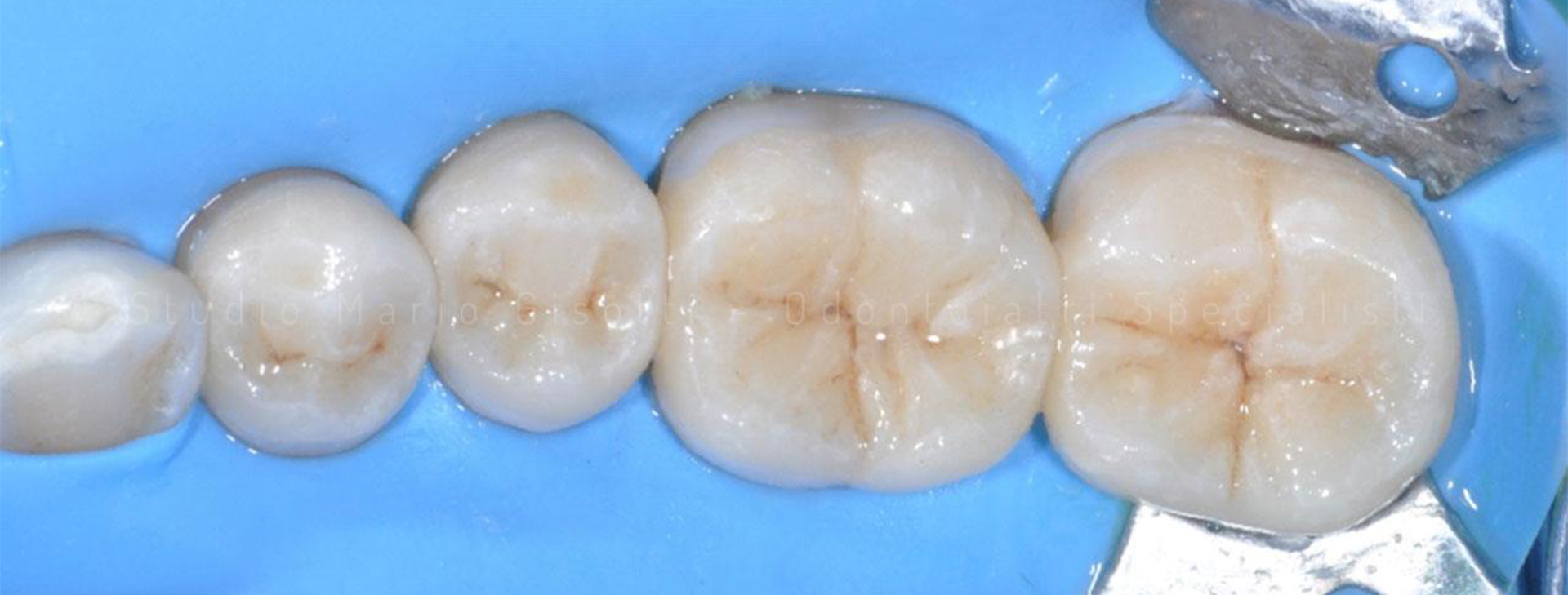 ODONTOIATRIA CONSERVATIVA