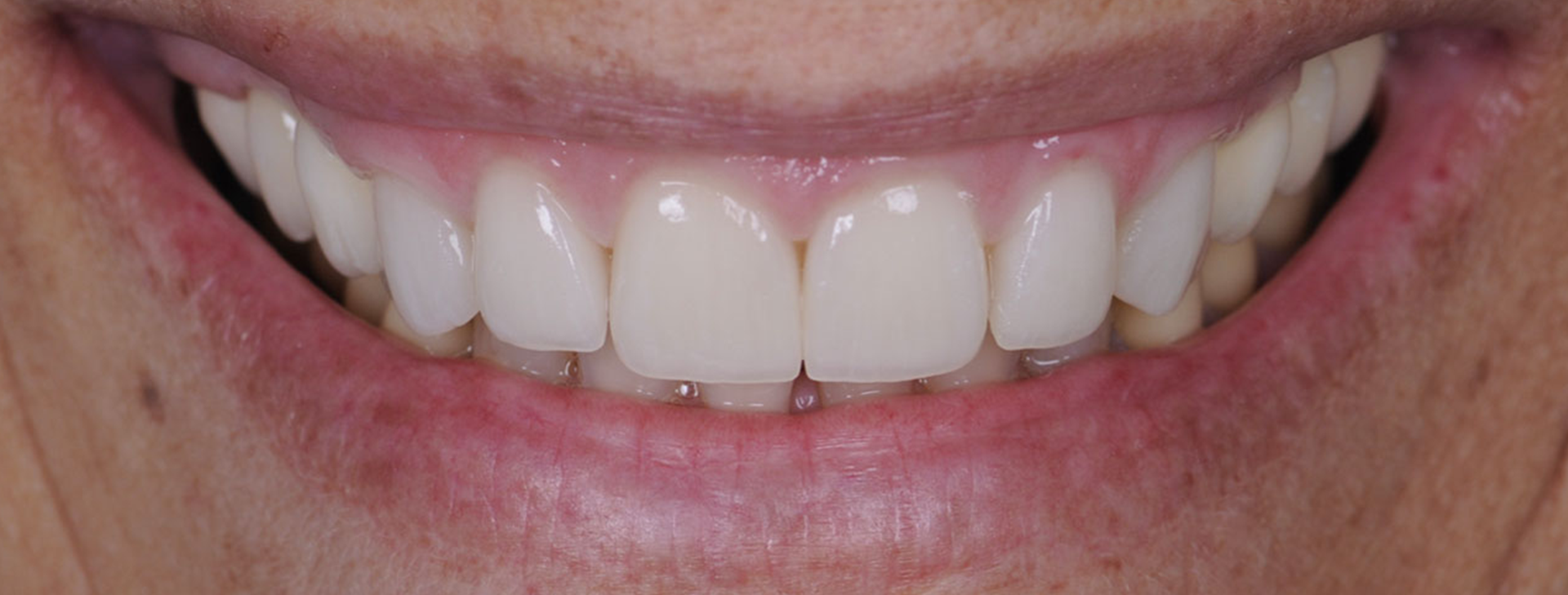 ODONTOIATRIA ESTETICA